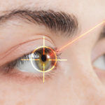 Laser Eye Surgery - Laser Center of Coral Gables - Coral Gables FL